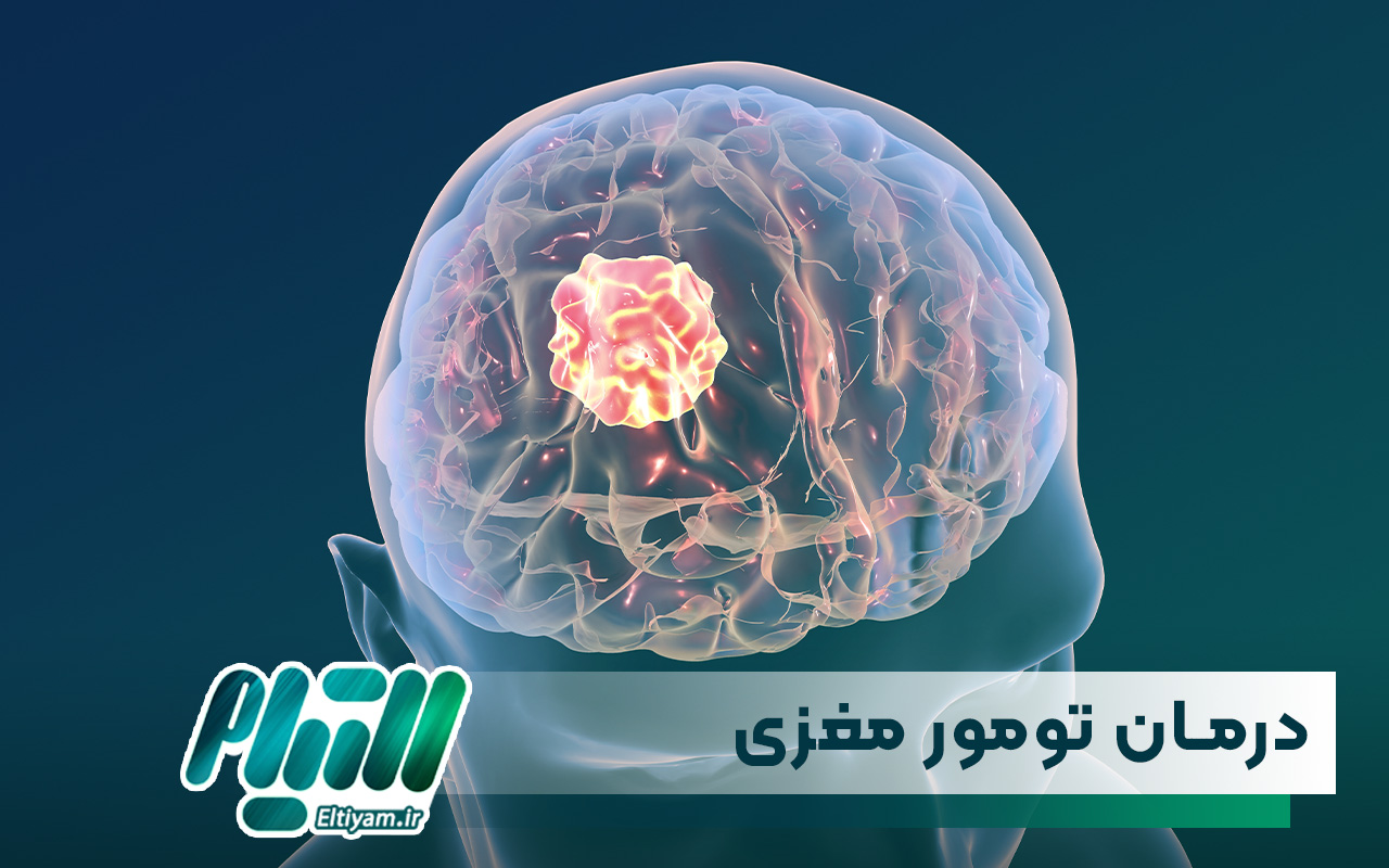 آیا تومور مغزی قابل درمان است؟