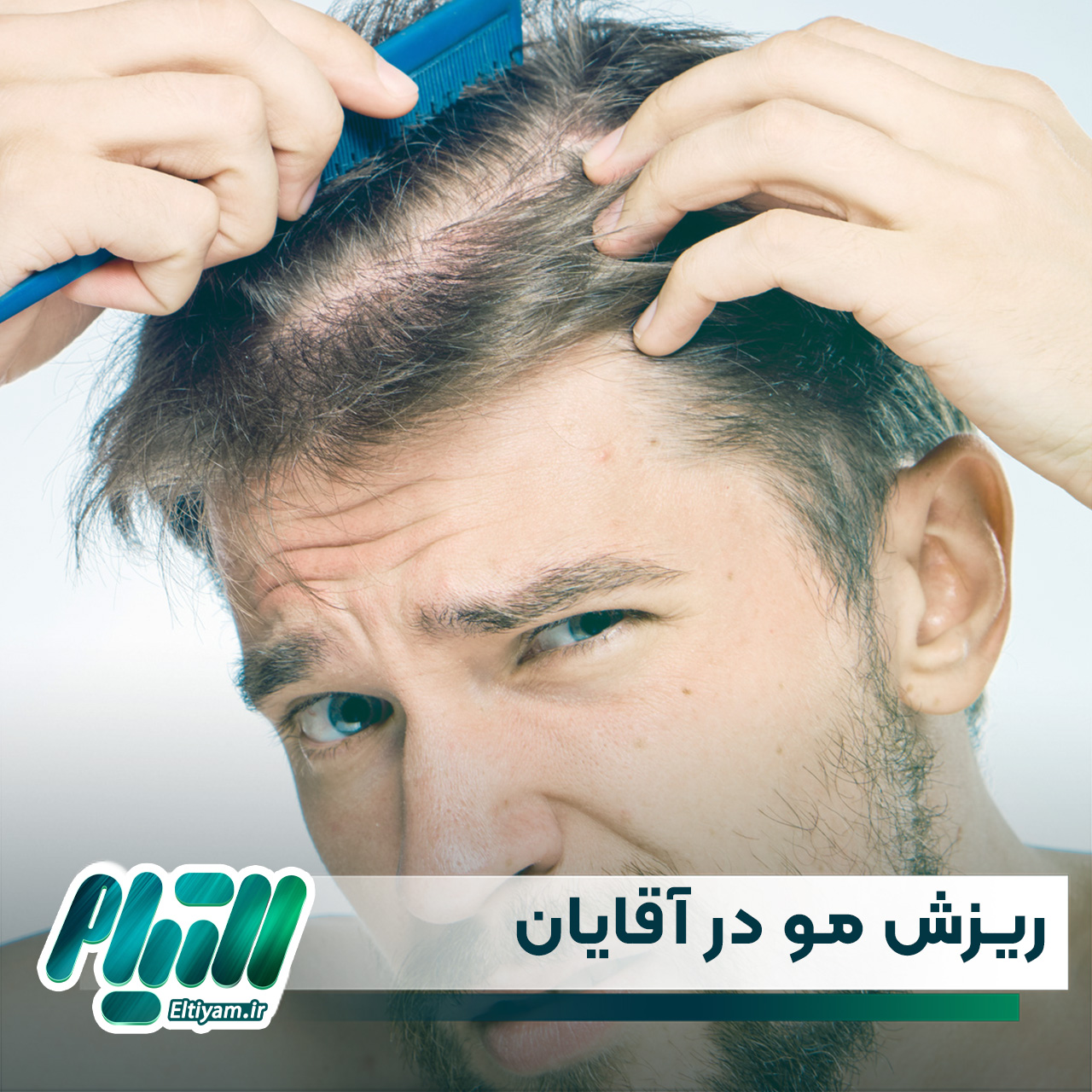 جلوگیری از ریزش مو در آقایان